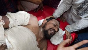 বাউফলে আ.স.ম ফিরোজের নেতৃত্বে উপজেলা চেয়ারম্যান মোতালেব হাওলাদারকে হত্যাচেষ্টায় বর্বর হামলা, প্রধানমন্ত্রীর দৃষ্টি কামনা