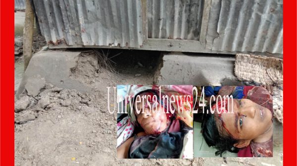 সিঁদ কেটে ঘুমন্ত অবস্থায় নানী ও নাতনীকে কুপিয়ে জখম