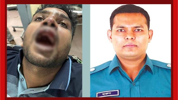ছাত্রলীগের কেন্দ্রীয় দুই নেতাকে নির্যাতন, একজনের দাঁত ফেলে দিলেন এডিসি হারুন